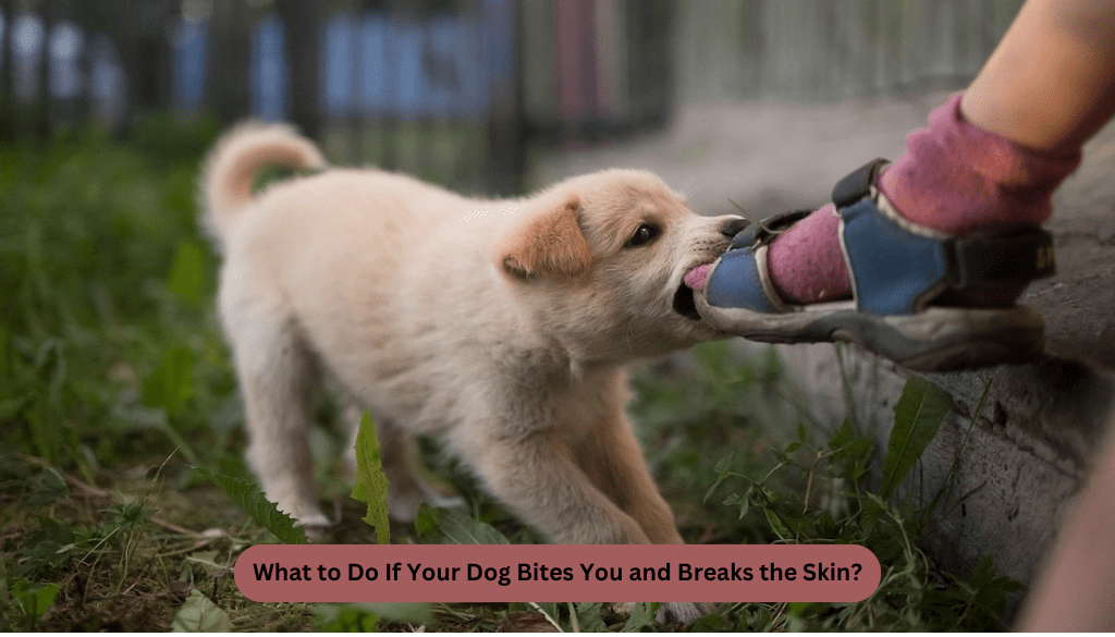 What to Do If Your Dog Bites You and Breaks the Skin